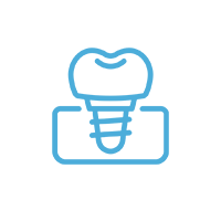 dental implant